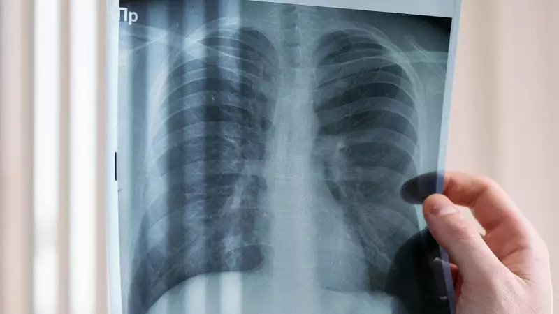 Non-Smoker's Lung Cancer Shock: Ghaziabad Woman's Story Reveals Hidden Health Threat