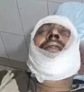 Brave Guards Thwart Robbery Attempt at Ludhiana Factory, Attacked