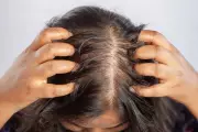 Hair Loss Drug Finasteride Poses Infant Risk from Maternal Exposure, Study Warns