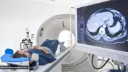 ICICI Bank & Tata Memorial Centre Forge Landmark Partnership to Revolutionise Cancer Care Infrastructure