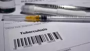 India Reports Highest TB Cases Globally in 2024, Drug-Resistant Variants Surge