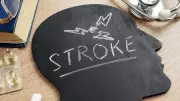Minor Stroke: A Critical Warning Sign for a Major Brain Attack, Warns Neurosurgeon