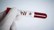 Six Children Test HIV Positive in Satna After Infected Blood Transfusion
