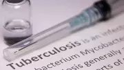 WHO Praises India's 'Encouraging Gains' in TB Elimination Drive