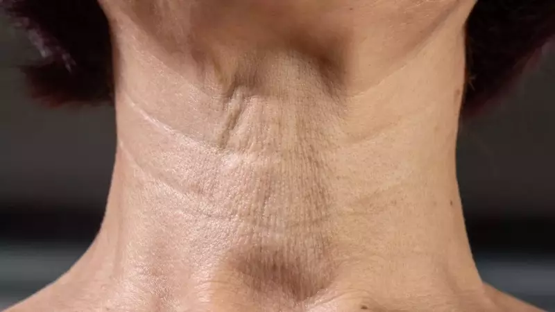 Bid Farewell to Neck Lines! 4 Natural Exercises to Tighten Sagging Skin
