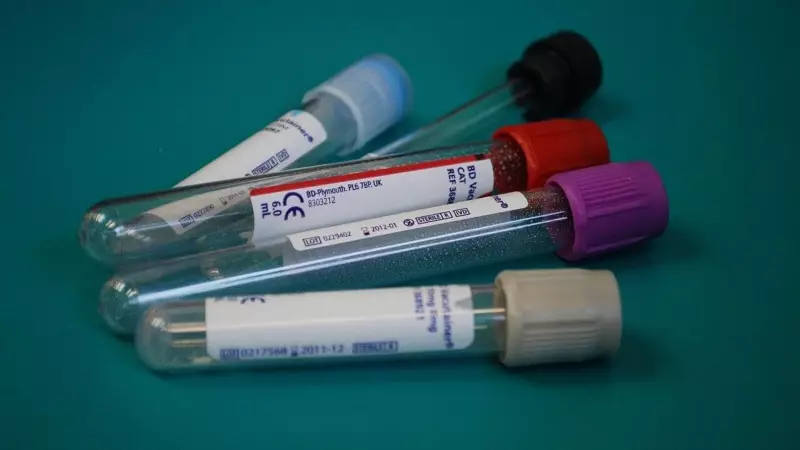 Dr Lal PathLabs Q2 Profit Surges 16% to ₹152 Crore, Announces ₹7 Dividend & 1:1 Bonus Shares