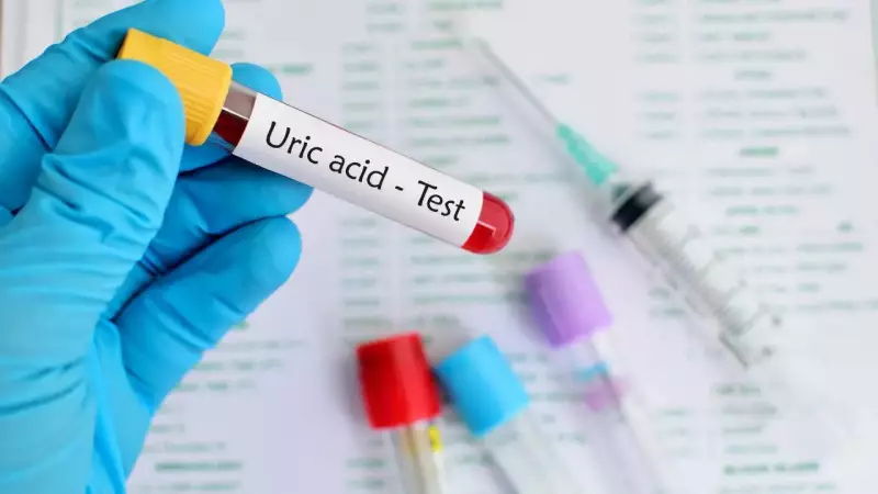 High Uric Acid Alert: 5 Kidney Stone Warning Signs You Must Know