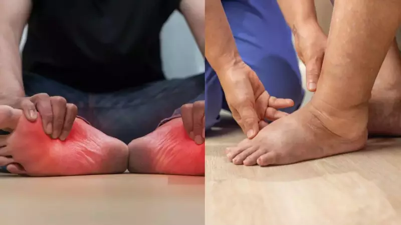 Lung Cancer Warning: Don't Ignore These Leg and Foot Symptoms - Pain, Swelling Could Signal Trouble