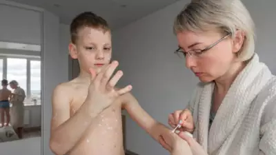 Measles Outbreak Alert: Utah-Arizona Border Emerges as New US Hotspot - Here's Why