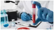 3 Life-Saving Health Tests You Can Do in 60 Seconds | Stanford Doctor Reveals