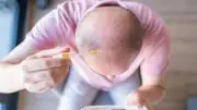 Baldness Breakthrough: Revolutionary Serum Promises Full Hair Regrowth in Just 20 Days!