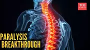 Paralysis Cure Breakthrough: Old Drug Shows Remarkable Spinal Cord Regeneration Potential