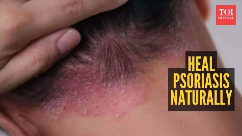 7 Natural Home Remedies to Soothe Psoriasis Symptoms Effectively