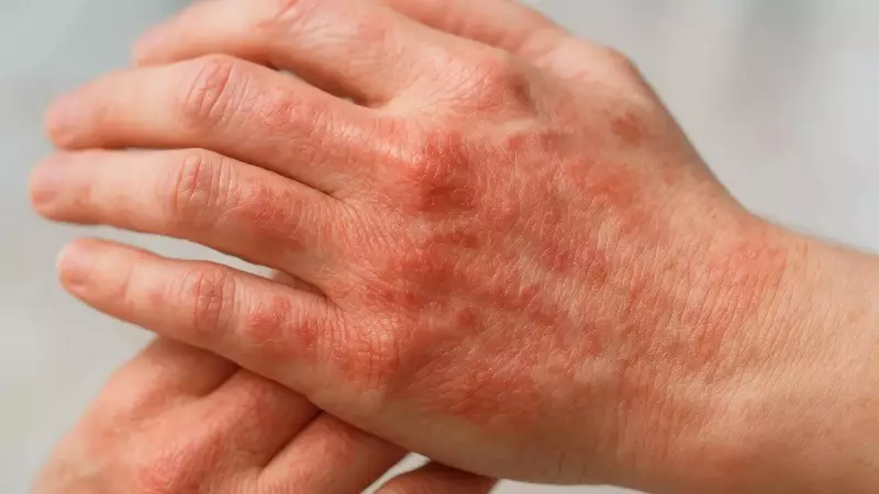 7 Skin Signs That Reveal Serious Health Problems