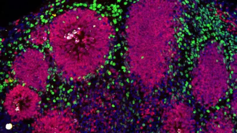NCBS Bengaluru Breakthrough: Unlocks Lowe Syndrome Brain Defects