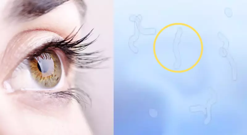 Seeing Spots or Floaters in Your Vision? Eye Doctors Reveal What's Happening Inside Your Eyes