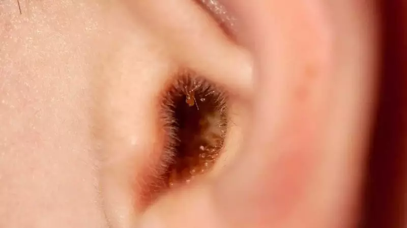 Why Using Earbuds to Clean Ears is Harmful: Doctors Warn