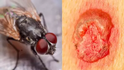 Fly Eggs in Wounds: 7 Critical Signs and Prevention Tips