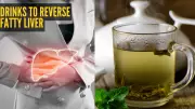 3 Expert-Approved Drinks to Reverse Fatty Liver Naturally
