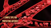 3 Natural Ways to Clear Arteries & Protect Heart Health