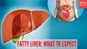 4 Stages of Fatty Liver Disease: Symptoms, Risks, and Recovery