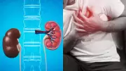 Chronic Kidney Disease: 6 Major Health Complications Explained