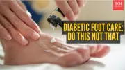 Diabetic Foot Care: How to Prevent Ulcers & Amputation