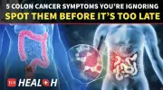 Don't Ignore These 5 Silent Signs of Colon Cancer | Dr. Deep Goel Explains