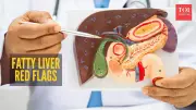 Fatty Liver Warning: 7 Silent Signs Your Liver is Crying for Help