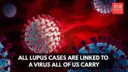 Stanford Study: Epstein-Barr Virus Causes 100% of Lupus Cases
