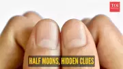What Your Nail's Half-Moon Reveals About Kidney Disease, Heart Health & More