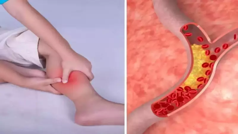 5 Night-Time Leg Symptoms That Could Signal High Bad Cholesterol
