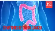 31-Year-Old Diagnosed with Colon Cancer: 6 Symptoms You Must Never Ignore