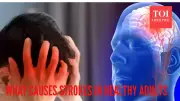 5 Hidden Stroke Causes in Young, Healthy Adults: Neurologist Explains