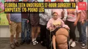 Florida Teen's 17-Hour Leg Amputation After Rare Growth Condition