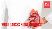 Kidney Stones: Beyond Water Myths, Causes, Types & Prevention Explained