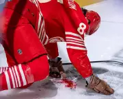 NHL Horror: Detroit's Elmer Soderblom Struck in Face by Puck, Game Halts