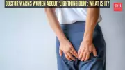 NHS Doctor Warns: 'Lightning Bum' Pain Could Signal Endometriosis