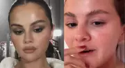 Selena Gomez Reveals Melasma, Not Moustache, in Candid Instagram Response