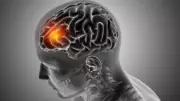 Stroke Warning Signs: 5 Symptoms You Must Never Ignore for Early Treatment
