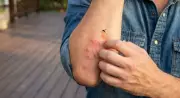 Why Mosquitoes Bite Some People More? Science Explains CO2, Blood Type & More