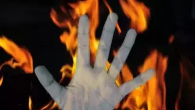 19-Year-Old Student Set on Fire Outside Bareilly's Hindu College After Exam