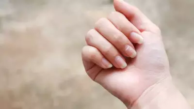 5 Nail Warning Signs You Must Not Ignore: Doctor's Alert