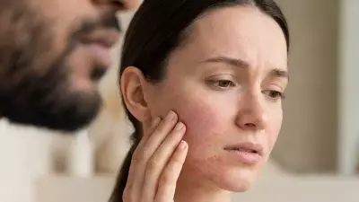 Beard Burn Explained: Why Kissing Can Cause Redness, Itching & How to Prevent It