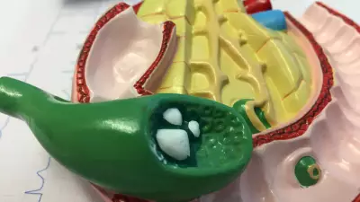 Hooghly Man's Patanjali Transformation: Ayurveda, Yoga Heal 3mm Stone