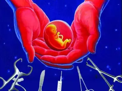 Jodhpur Doctors Save Mother & Baby by Removing 6.3kg Uterine Fibroid