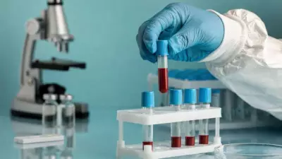 Nipah Virus Outbreak: Key Symptoms, Causes, and Prevention Steps