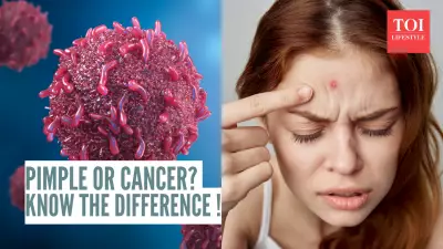 Not a Pimple: Dermatologist Warns of Skin Cancer That Mimics Common Bumps