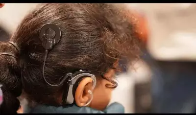 Patna Aims for 500 Cochlear Implants by Mid-2026 in Deafness-Free Mission