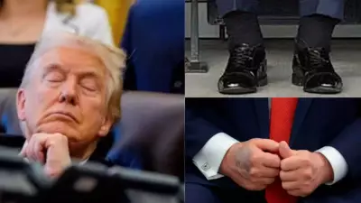 Trump's Health Scrutiny: MRI vs CT Scan Confusion & Aspirin Bruises